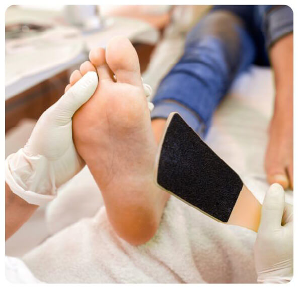 画像：足の角質ケア